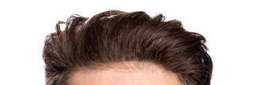 The top of Adam's head
